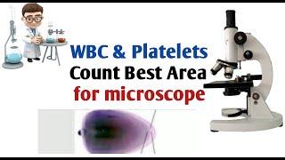 Platelets & wbc under microscope I wbc & platelets count