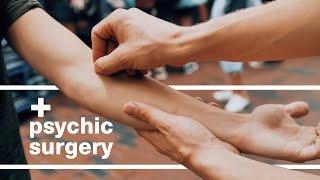 Psychic Surgery by Aaron Alexander (Perform Invisible Surgery on Strangers)