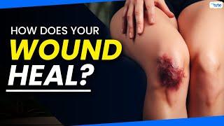 How Does Your Wound Heal? | Understanding the Process of Wound Healing| Letstute🩹