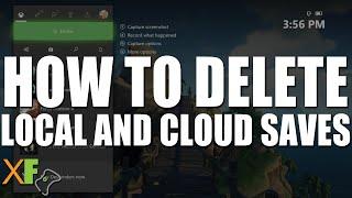 How to delete local and cloud save data on Xbox One and Series S/X