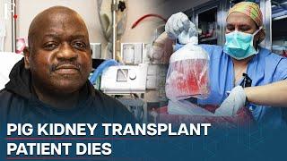 First-Ever Pig Kidney Transplant Patient Dies Nearly 2 Months After Procedure
