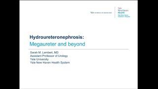 5.26.2020 PedsUroFLO Lecture - Hydroureteronephrosis: Megaureter and Beyond