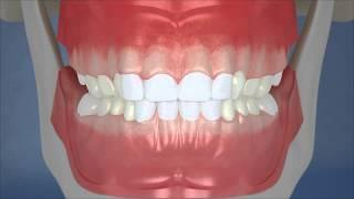 Dental Development - Center View (HD)