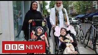 Separated twins Marwa and Safa return home after months of treatment - BBC News