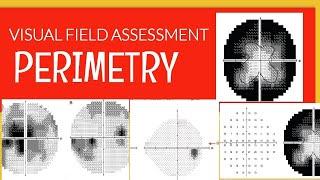 PERIMETRY|| How to read a visual field printout?