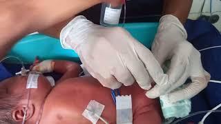 new born #baby|| #male Catheterization by nursing staff||tirgar BØY VLOG August 2023