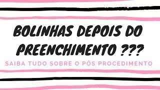 Por que ficamos com bolinhas depois do preenchimento ?