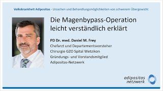 Vortrag "Die Magenbypass-Operation leicht verständlich erklärt."