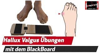 Hallux Valgus - Physiotherapeut erklärt das Problem und zeigt hilfreiche Übungen