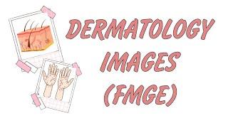 DERMATOLOGY | Images | fmge #fmge #fmge_mci_exam #fmgepreparation #fmgejan2024