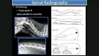 Spinal lecture 1 Intro and congenital