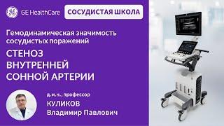 Сосудистая школа GE Healthcare. Стеноз внутренней сонной артерии. Сессия №2