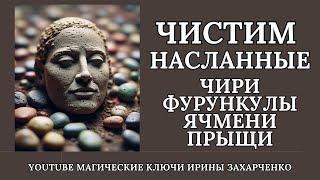 Насланные ЧИРИ, ФУРУНКУЛЫ, ЯЧМЕНИ, ПРЫЩИ, ГНОЙНИЧКОВЫЕ ОБРАЗОВАНИЯ. СНИМАЕМ ПОРЧУ и чистим КОЖУ.