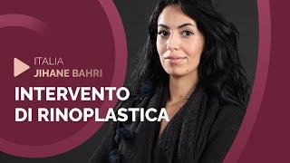 Rhinoplasty in Turkey | Natural Clinic | Rhinoplasty Story