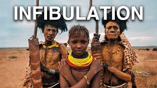 THE DIMI RITUAL: The Passage from Girlhood to Womanhood in the Dassanech Tribe 