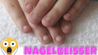 NAGELBEISSER EXTREM!  Tipps undAnleitung für Gelnägel Modellage | Lyninails