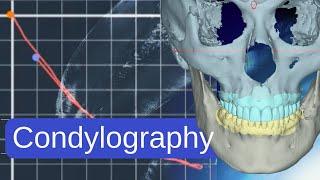 Condylography and joint click