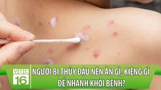 Người bị thủy đậu nên ĂN GÌ, KIÊNG GÌ để nhanh khỏi bệnh? | Dinh dưỡng đúng và đủ | VTC16