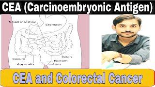 CEA Test || Carcinoembryonic Antigen