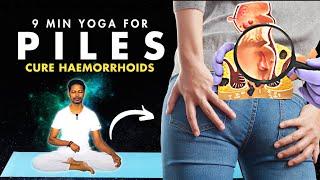 Piles Exercise at Home | Yoga for Piles | Yoga for Piles and Fissures