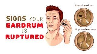 8 Signs Your Eardrum is Ruptured