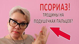 ПСОРИАЗ: трещины на подушечках пальцев?