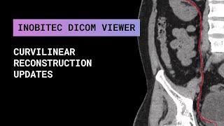 Curvilinear reconstruction updates in Inobitec DICOM Viewer Pro