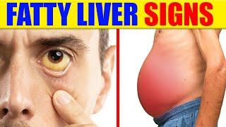 12 Warning Signs And Symptoms Of Fatty Liver To Not Ignore