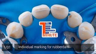 Individual marking for rubberdam. 1 Minute 1/01