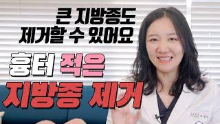 지방종, 어디 가면 제거해줘요? | 흉터 많이 안 생기는 지방종 제거