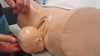 Vaginal Birth