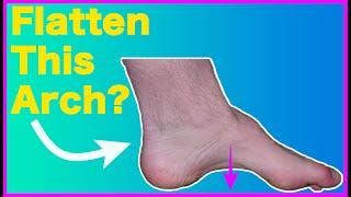 High Foot Arch – This 1 Trick Fixes It