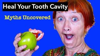 How to Heal Tooth Decay - Oakville Dentist, Dr Agatha Bis