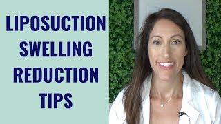 Liposuction Healing & Recovery Tips | How to REDUCE Lipo Swelling | Post Liposuction Care Guide