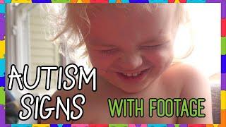 EARLY AUTISM SIGNS | Three Years Old (Incl. Footage)