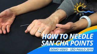 How to Needle San Cha? can treat radicular pain! #譚針 #韓玉齡 #eileenhan #balancemethodacupuncture #正宗譚針