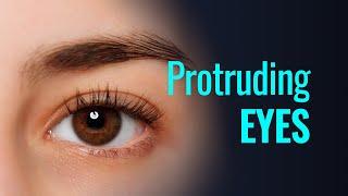 PROTRUDING EYES - What is my eye shape?