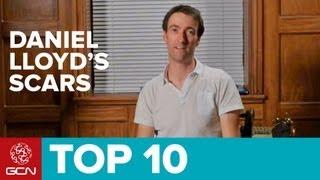 Daniel Lloyd's Top 10 Scars