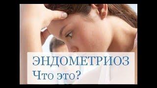 ЭНДОМЕТРИОЗ - что это?