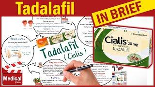 Tadalafil ( Cialis ): What is Tadalafil Used For, Dosage, Side Effects & Precautions?