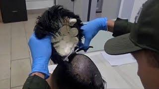 Colombian man arrested for hiding cocaine under toupee at Cartagena airport