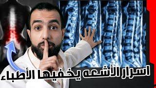 كيف تقرأ صور رنين الظهر وتشخص الاعراض التي تعاني منها | Lumbar MRI