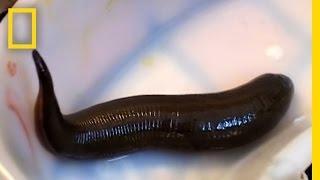 Leeches Cure | National Geographic