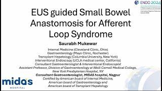 EUS Guided Small bowel Anastomosis for Afferent Loop syndrome By Dr. Saurabh Mukewar
