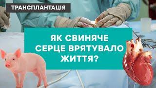 МЕДИЧНИЙ ПРОРИВ: як серце свині врятувало життя