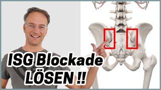 ISG Blockade SOFORT lösen (nur eine Übung notwendig)