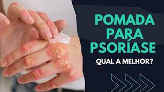 Qual MELHOR POMADA PARA PSORÍASE? [ SAIBA! ]