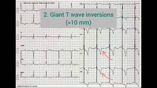 ECG Quiz 17