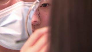 Rush for plastic surgery before mask-wearning ends in South Korea