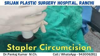 Best Circumcision technique| stapler Circumcision in Ranchi| Best hospital for circumcision